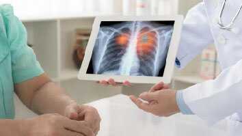Health Check Podcast: Why is lung cancer no.1 killer among cancers?